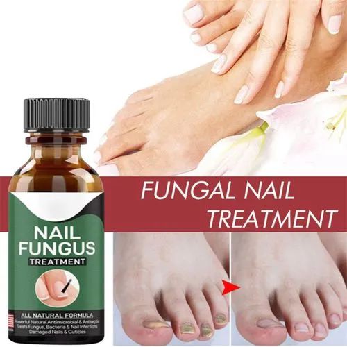 Fast Nail Fungus Treatment – Nail Repair Essence & Anti-Fungal Gel for Healthy, Clear Nails